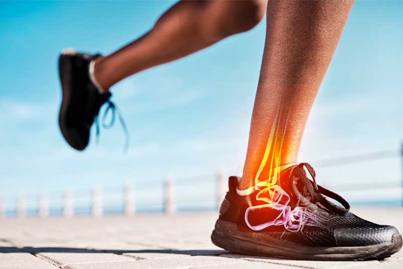 Running shoes, legs or skeleton bone glow in workout, training or exercise with anatomy pain, body stress or joint burnout. Zoom, runner or sports woman with ankle injury and 3d futuristic abstract