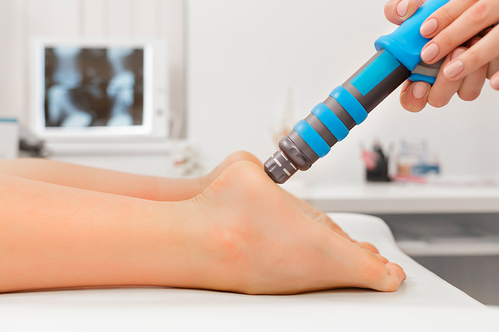 Focused shockwave therapy over feet